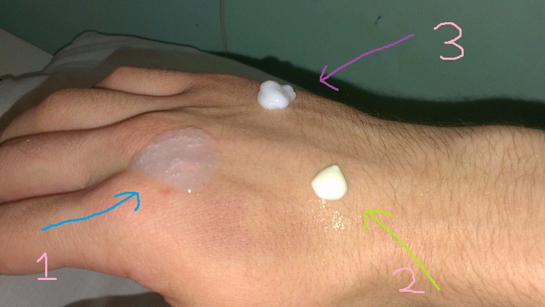 OBAGI ON HAND acne treatment