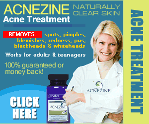 revitol Acnezine review for mild, moderate and severe acne.