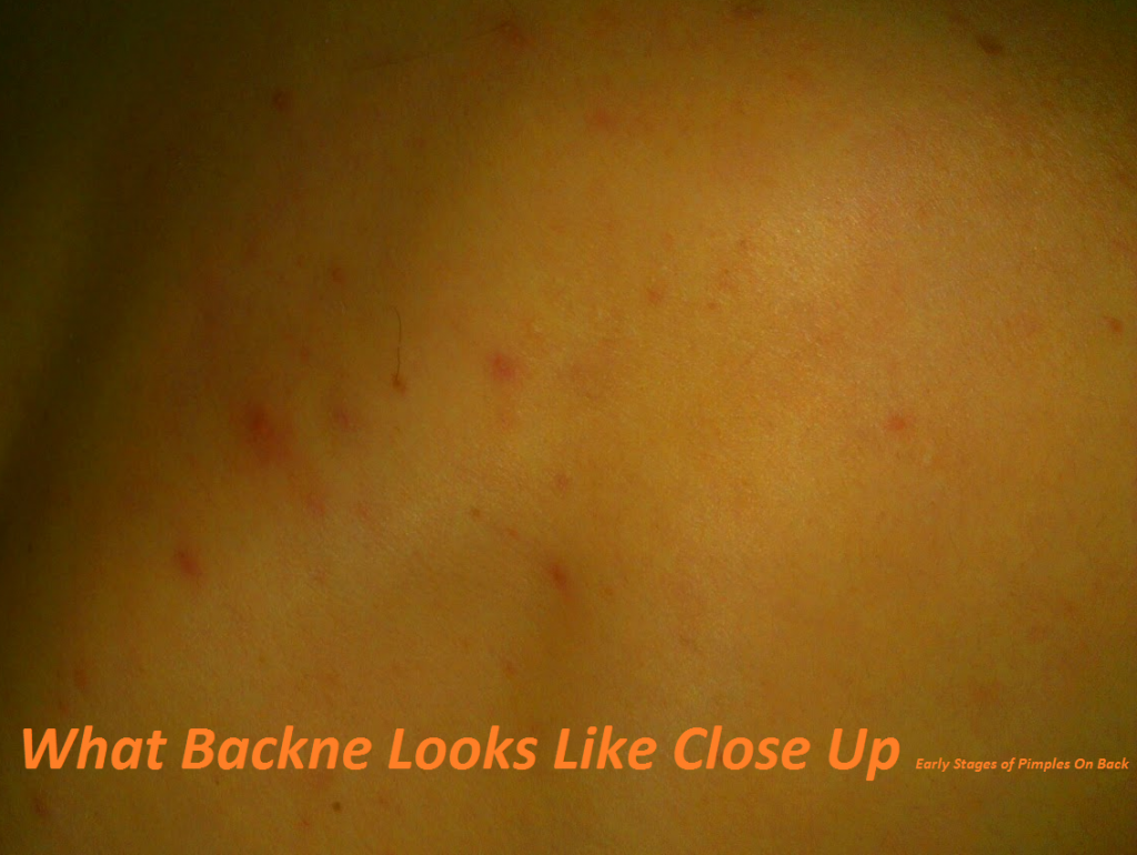 Backne Close Up Picture